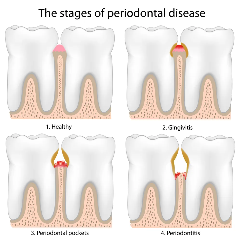 Periodontology