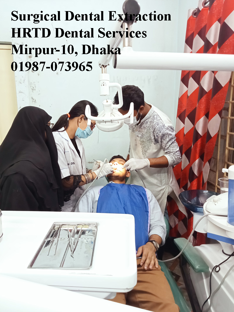 Best Surgical Dental Extraction. Mobile No. 01987-073965