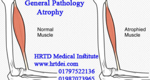 General Pathology