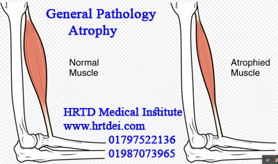 General Pathology 