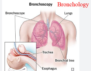 Bronchology