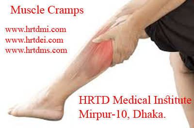 Muscle Cramps Image